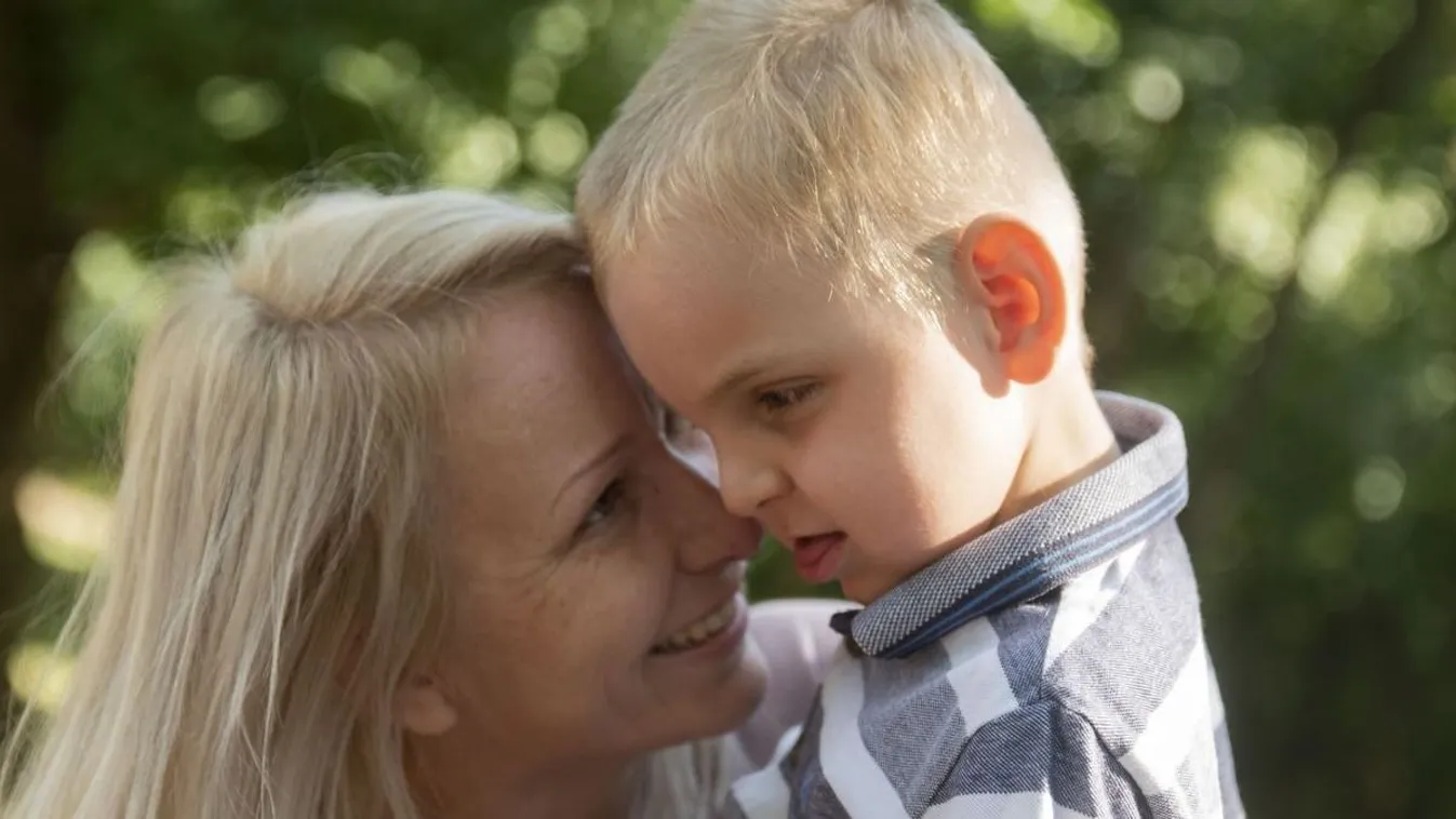 Esőgyermek Zsombi: megható segítséget kap a 8 éves kisfiú