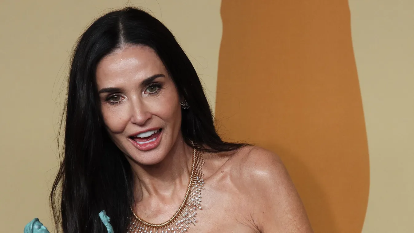 Ozempic őrület: a rajongókat sokkolták a SAG Awards csontsovány sztárjai