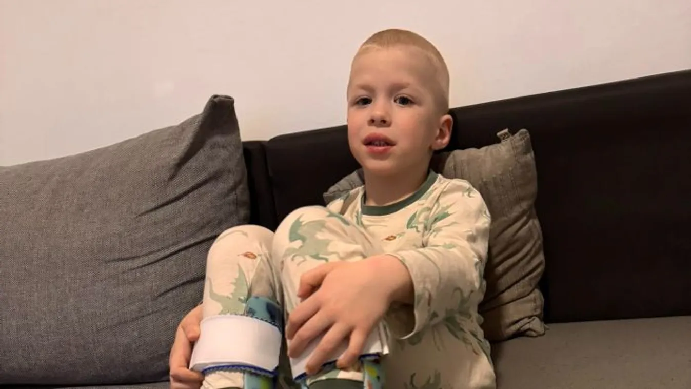 Új eszközt kell viselnie duchenne-es Ádinnak, így van most