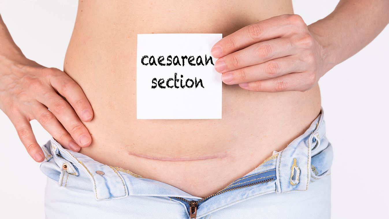 Majdnem megfulladtam császármetszés közben