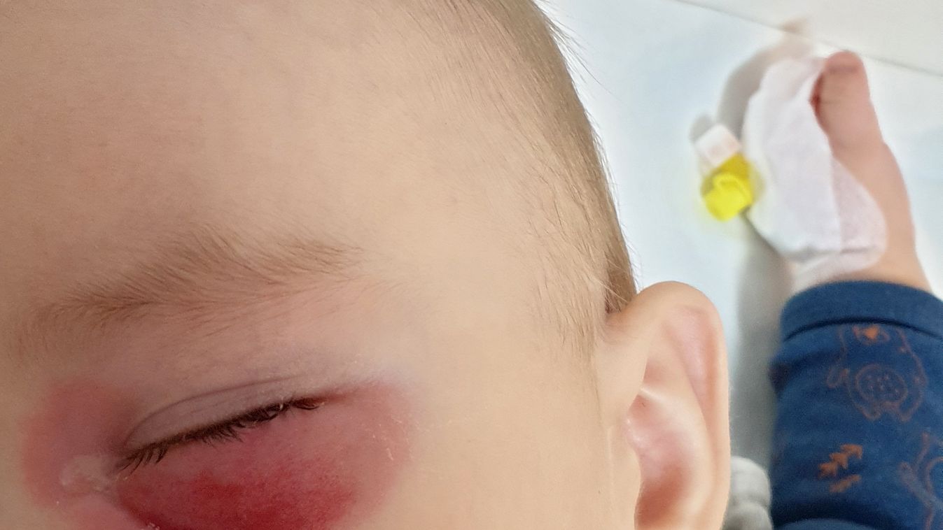 Tizennyolcszor szúrták meg a 8 hónapos babát