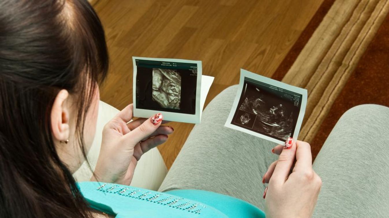 Így kell elájulni a nőgyógyásznál, fekve