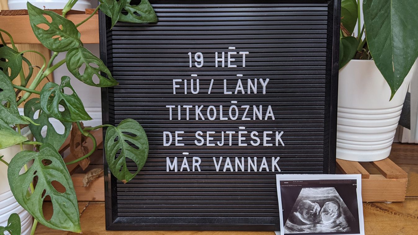 Terhesnapló: Kiteregetjük a szennyest!