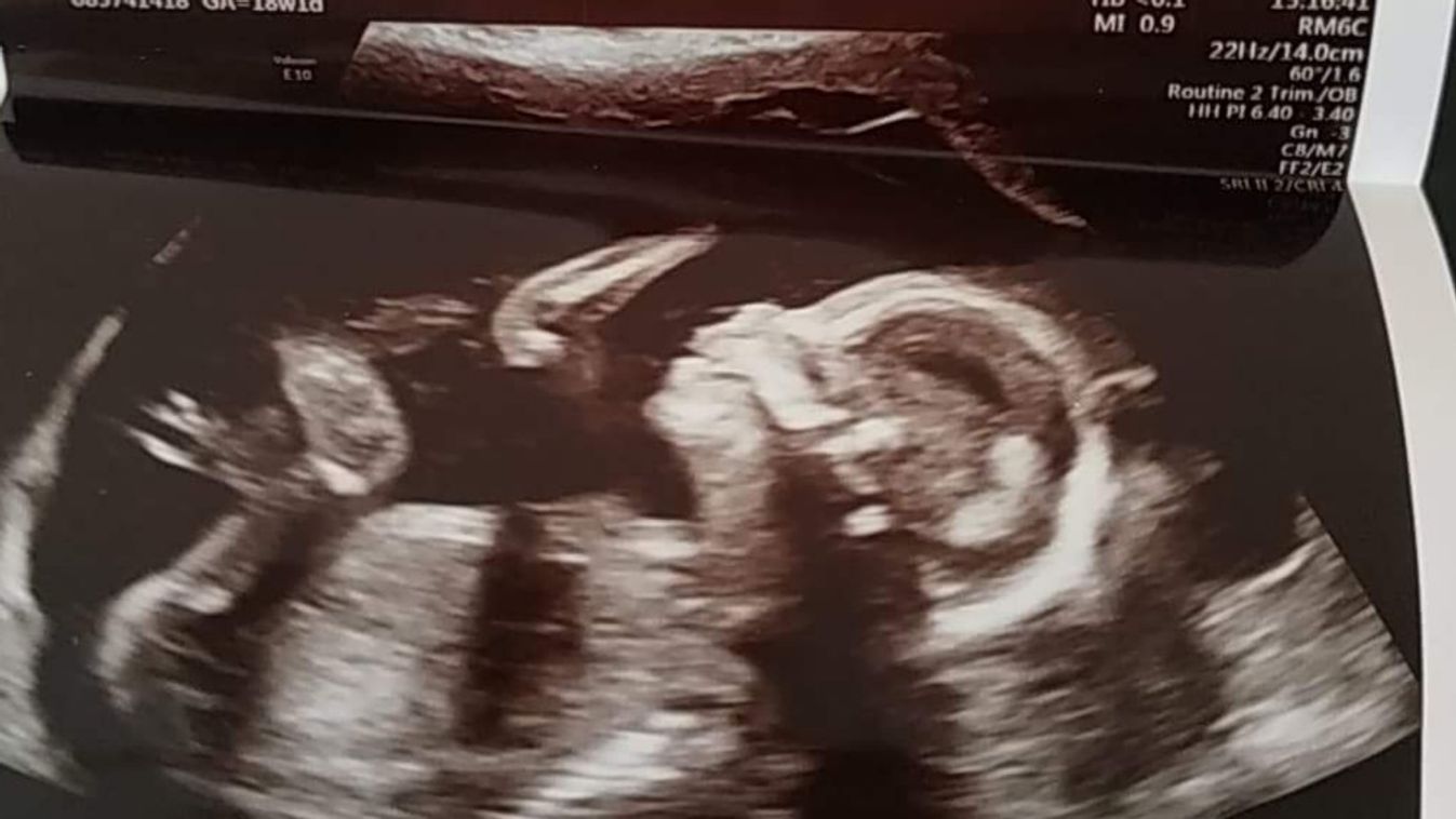 Mindenáron hasba akart szúrni a doktornő