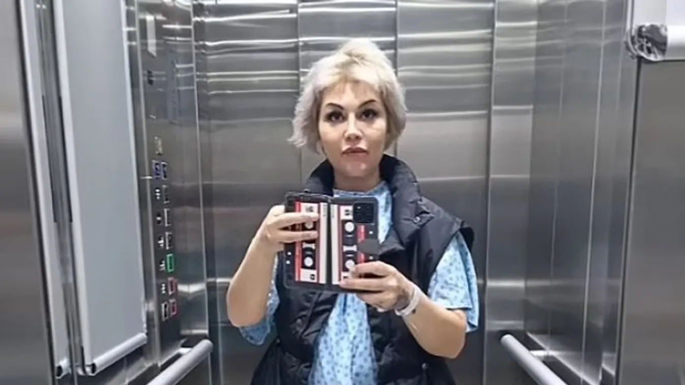„Mintha cápa harapott volna belém” – Csak szebb akart lenni, majdnem a nő életébe került