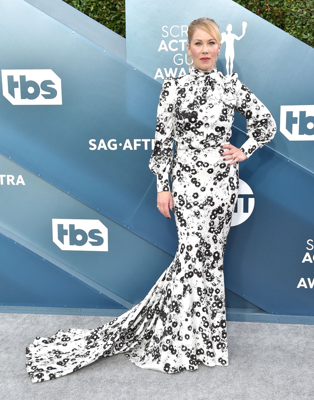 Christina Applegate 2021-ben osztotta meg a nyilvánossággal, hogy szklerózis multiplex betegséget diagnosztizáltak nála