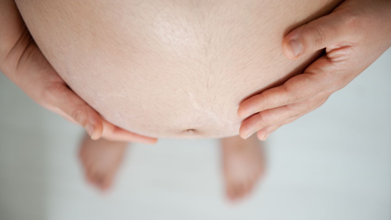 Hamarabb jött a baba, szőrös lábbal szültem