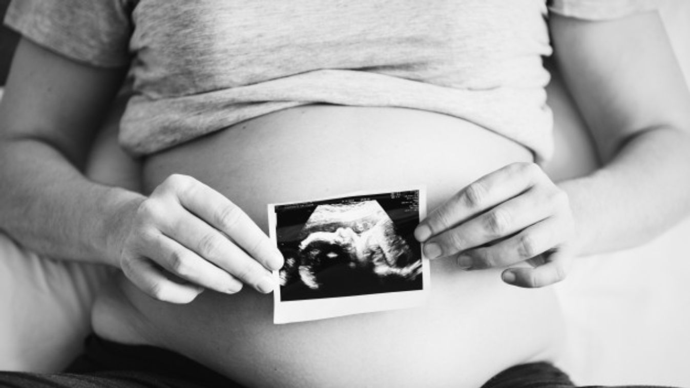 24 éves lenne a lányom. 38 hetesen meghalt bennem