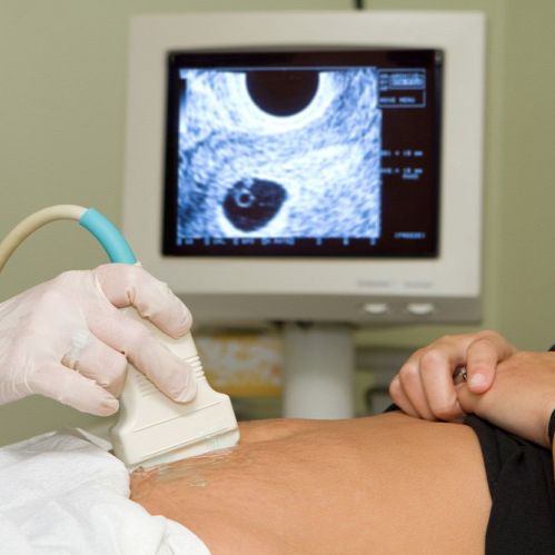 Rozália lombik spermadonor