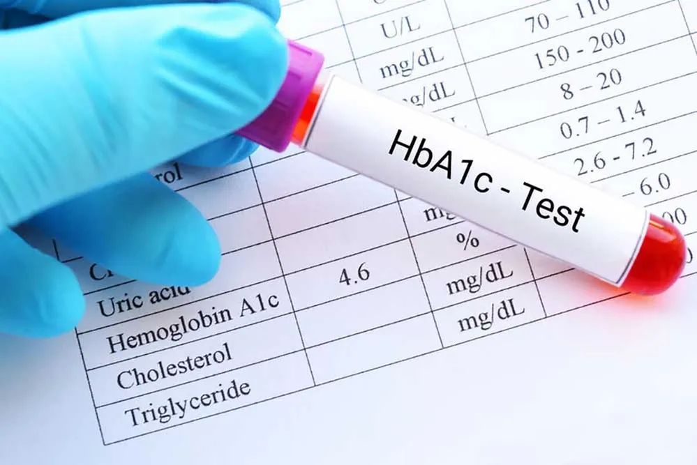 hba1c, cukorbeteg