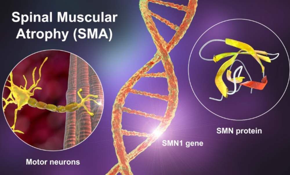 SMA
