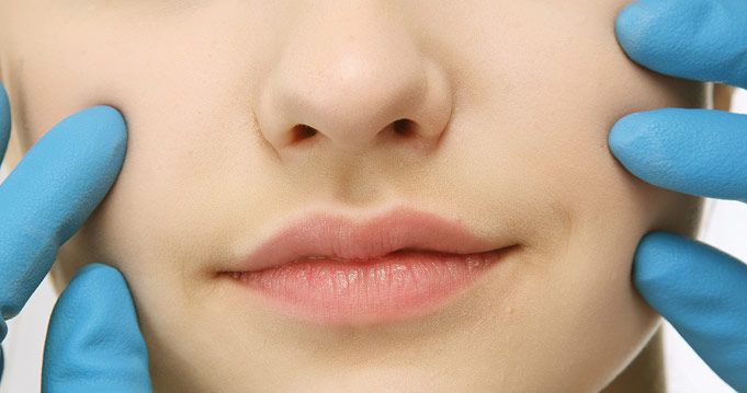 botox