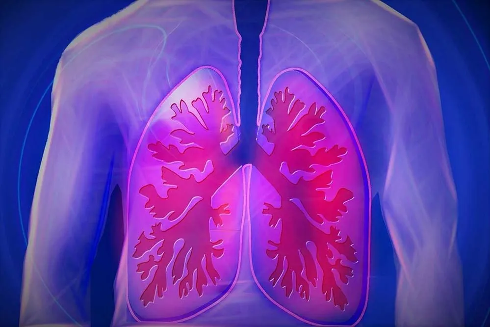 COPD, tüdő