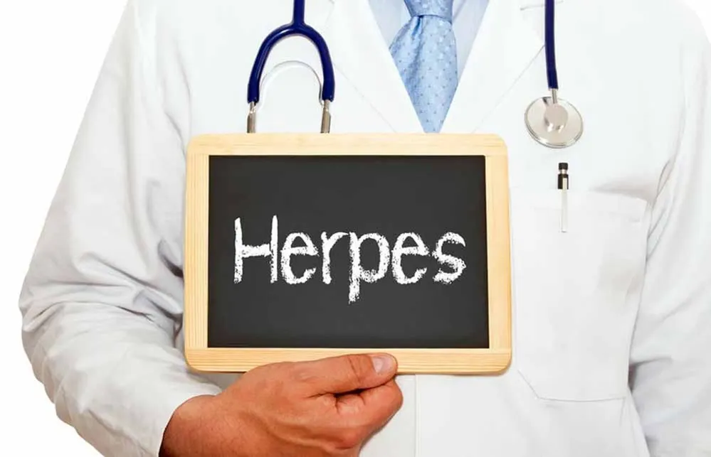 nemi herpesz