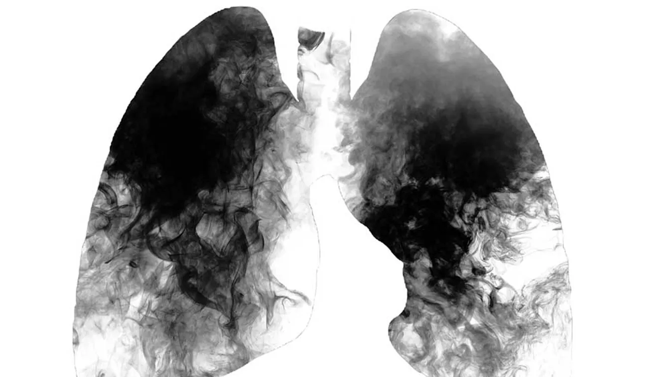 Sokat tehetünk a COPD súlyos következményei ellen