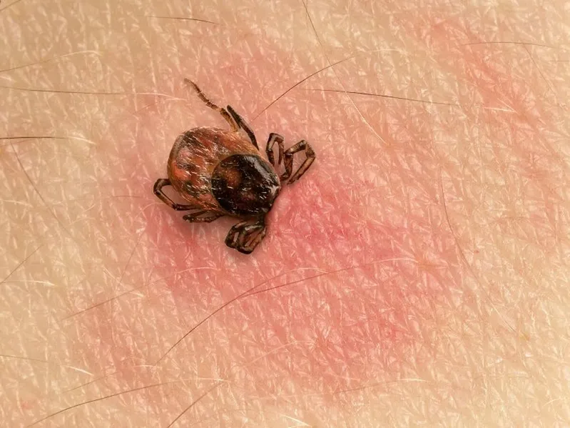 kullancs, lyme kór