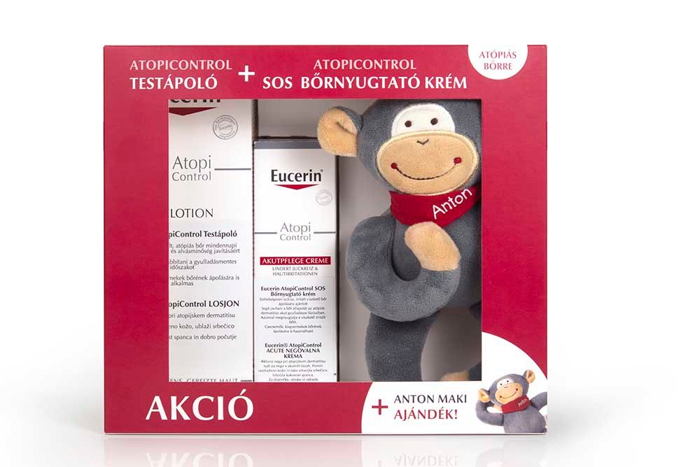 atópiás ekcéma