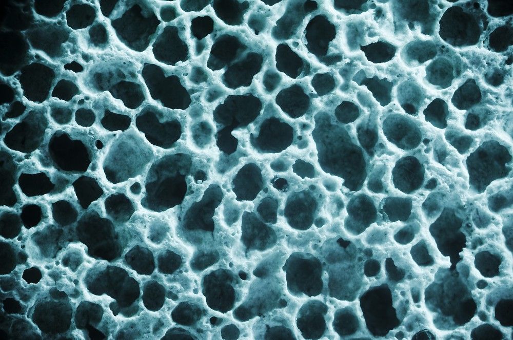 csontritkulas, csont