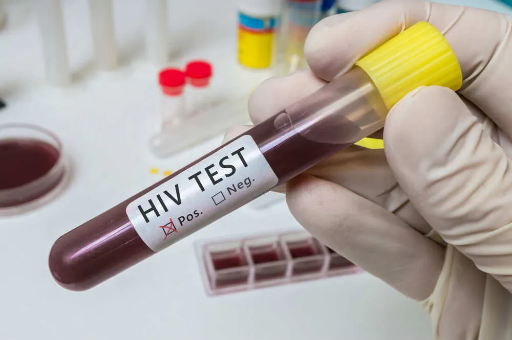 hiv-fertozott