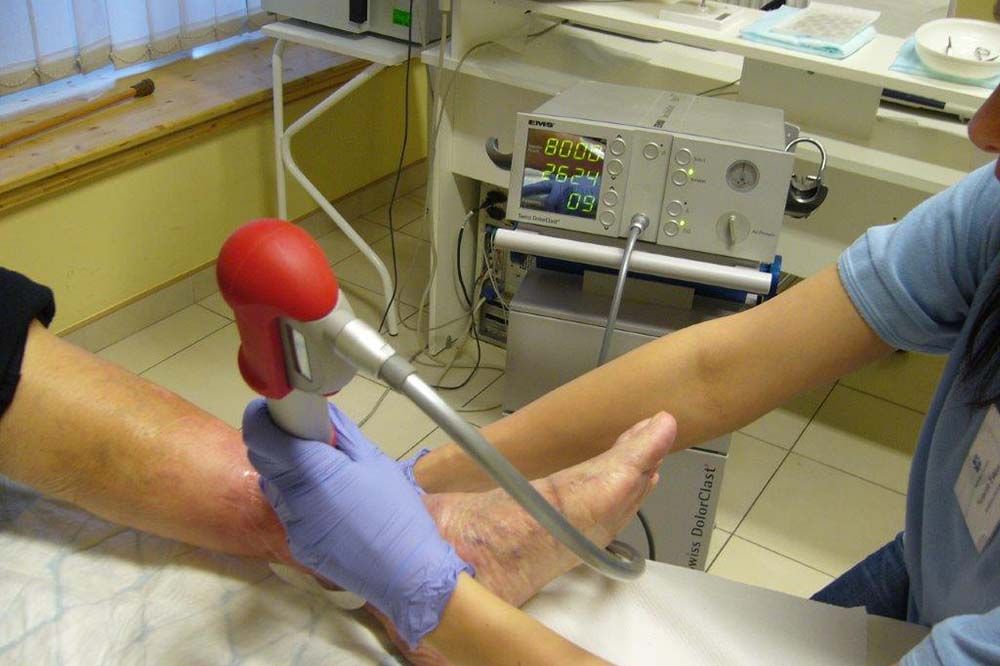 diabéteszes láb, lábszárfekály