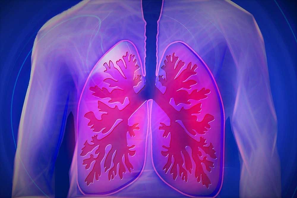 COPD, tüdő