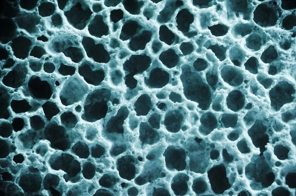 csontritkulas, csont
