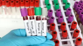 Nagyobb eséllyel leszel rákos, ha ilyen a vércsoportod