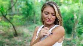 Egyetlen darázscsípés is életveszélyes lehet – Nem mindegy mit teszel, hogy elkerüld a nagyobb bajt!