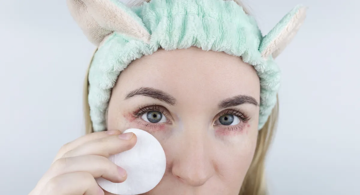 Allergy,To,Cosmetics.,The,Girl,Looks,At,The,Pimples,Around