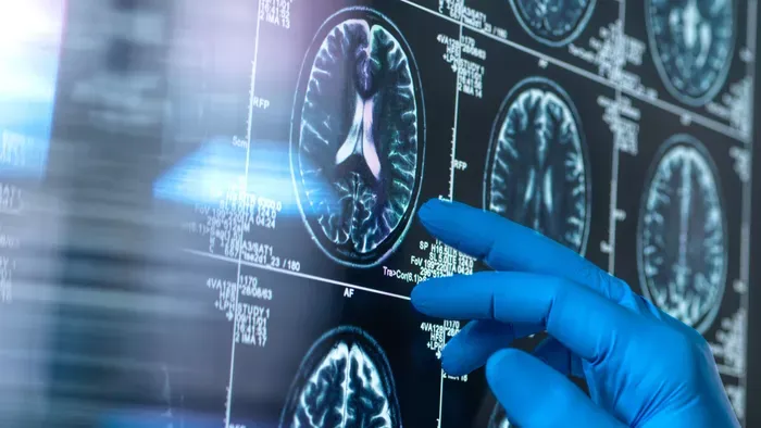 "Összeomlott a világom"- agyrákkal diagnosztizálták az anyát