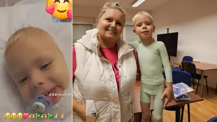 Szörnyű emlékei vannak Ricsikének, akire forró olaj ömlött