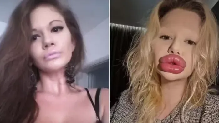 Igazi természetes szépség volt világ legnagyobb ajkú nője