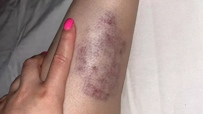 Pusztító vihar: tűzgolyók is cikáztak, egy lány megsérült
