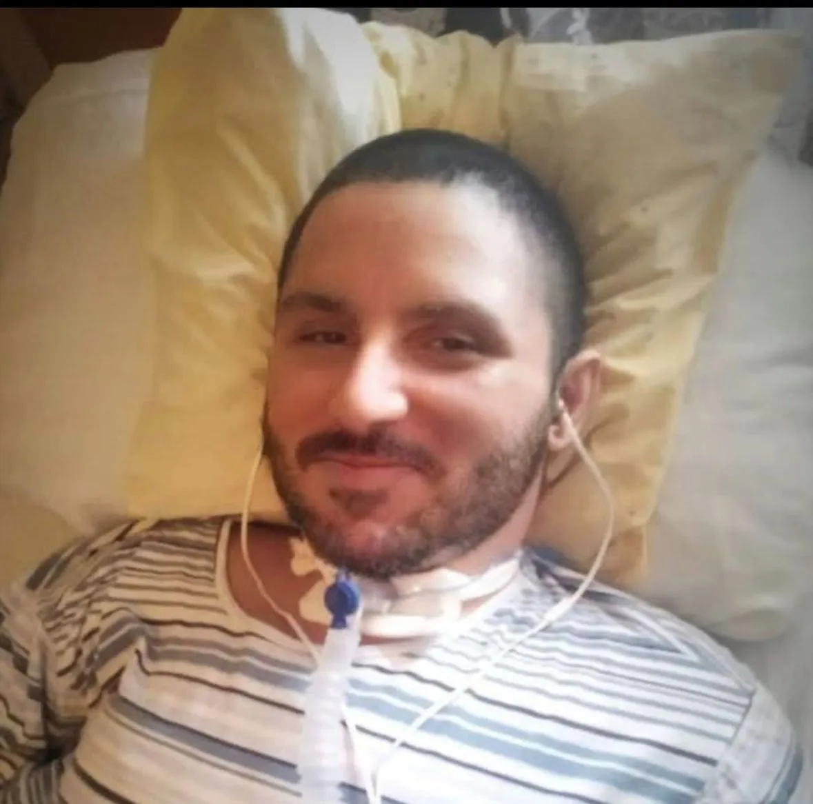 duchenne