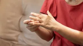 Szorít a gyűrű? – Ez a súlyos betegség is állhat az állandó ujjdagadás hátterében