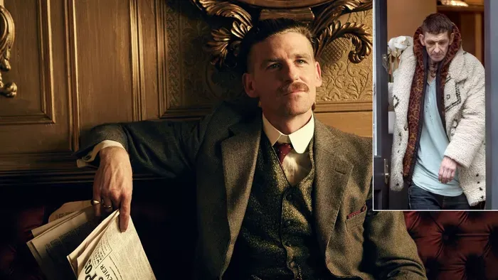Pokoli állapotban van a Peaky Blinders világsztárja – Fotók