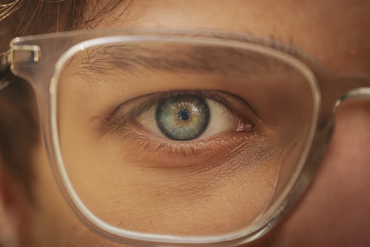 Kék szemszín, Írisz, Retina, Pupilla, Szemüveglencse