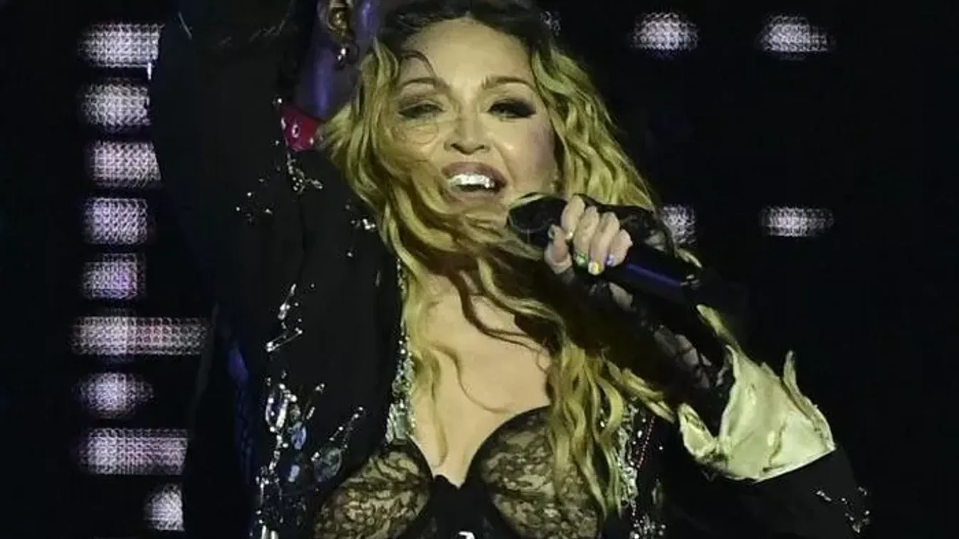 Madonna szakított a plasztikával – fiatal szerelme teljesen átformálta