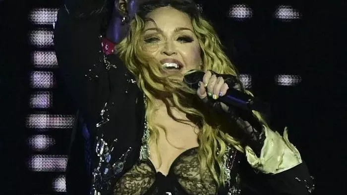 Madonna szakított a plasztikával – átformálta a szerelem