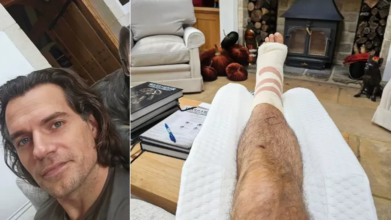Kiderült, mi Henry Cavill baja — Balesete után már mosolyogni is tud a színész
