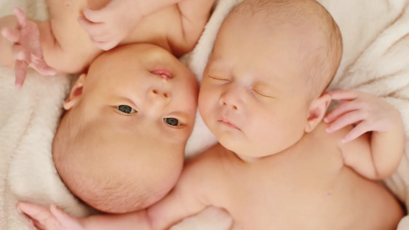 Ritka betegséget diagnosztizáltak a babánál – órákkal később kiderült, hogy ikertestvére is ugyanabban szenved