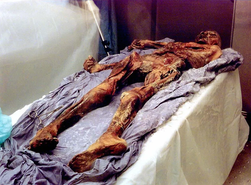 Ötzi a jégember