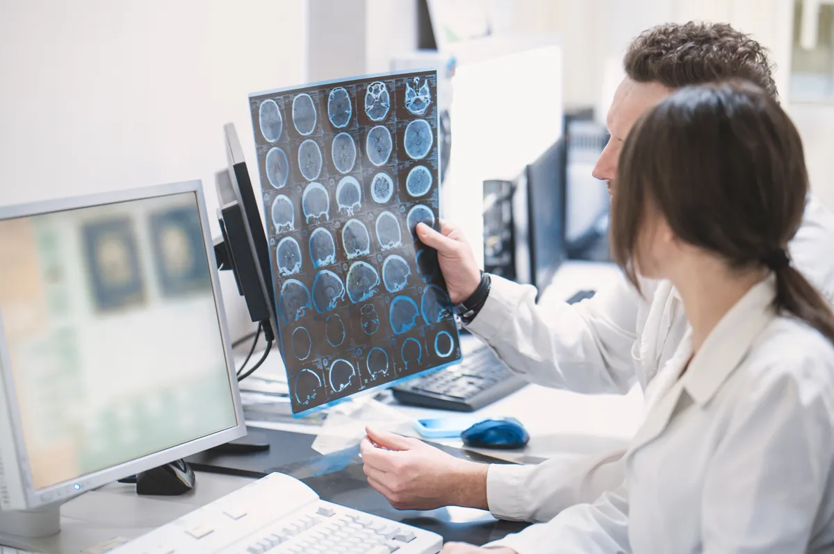 Agyi MRI-felvételek alapján Alzheimer-kórt diagnosztizáló orvosok