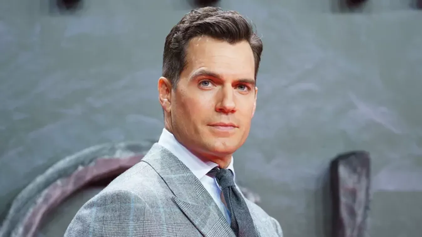 Komoly sérült szenvedett forgatás közben Henry Cavill, veszélybe került a filmje
