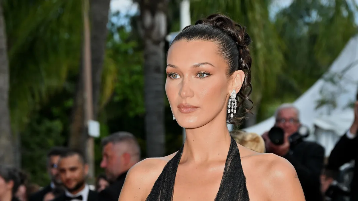 Bella Hadid nagy aggodalmat okozott rajongói számára.