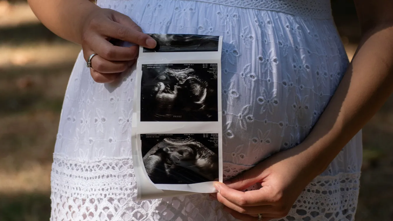 Máris babát vár a Házasság első látásra sztárja – így közölte az örömhírt a szőke szépség