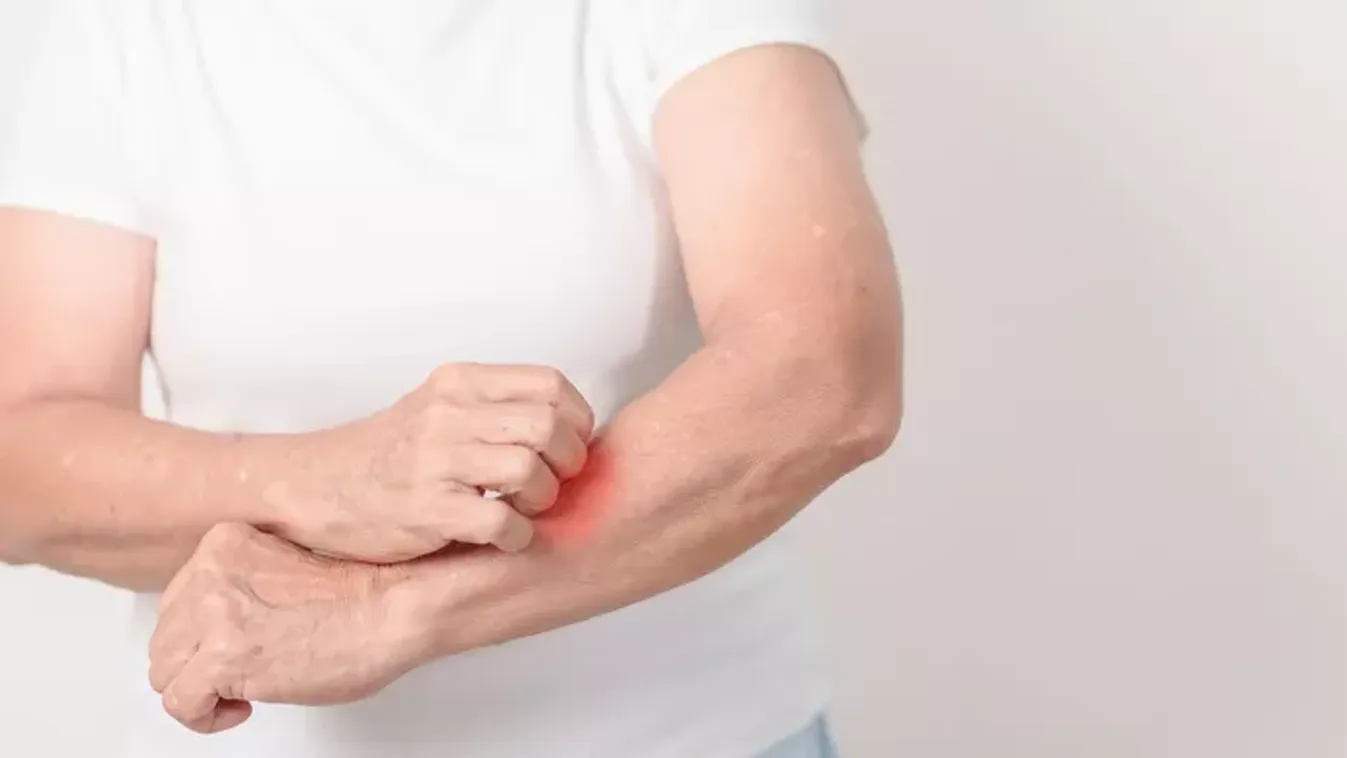 Bőrgyulladás – amikor a bőr védekezni próbál