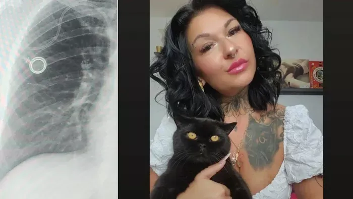 Julianna egy év után tudta meg, hogy mellrákja van