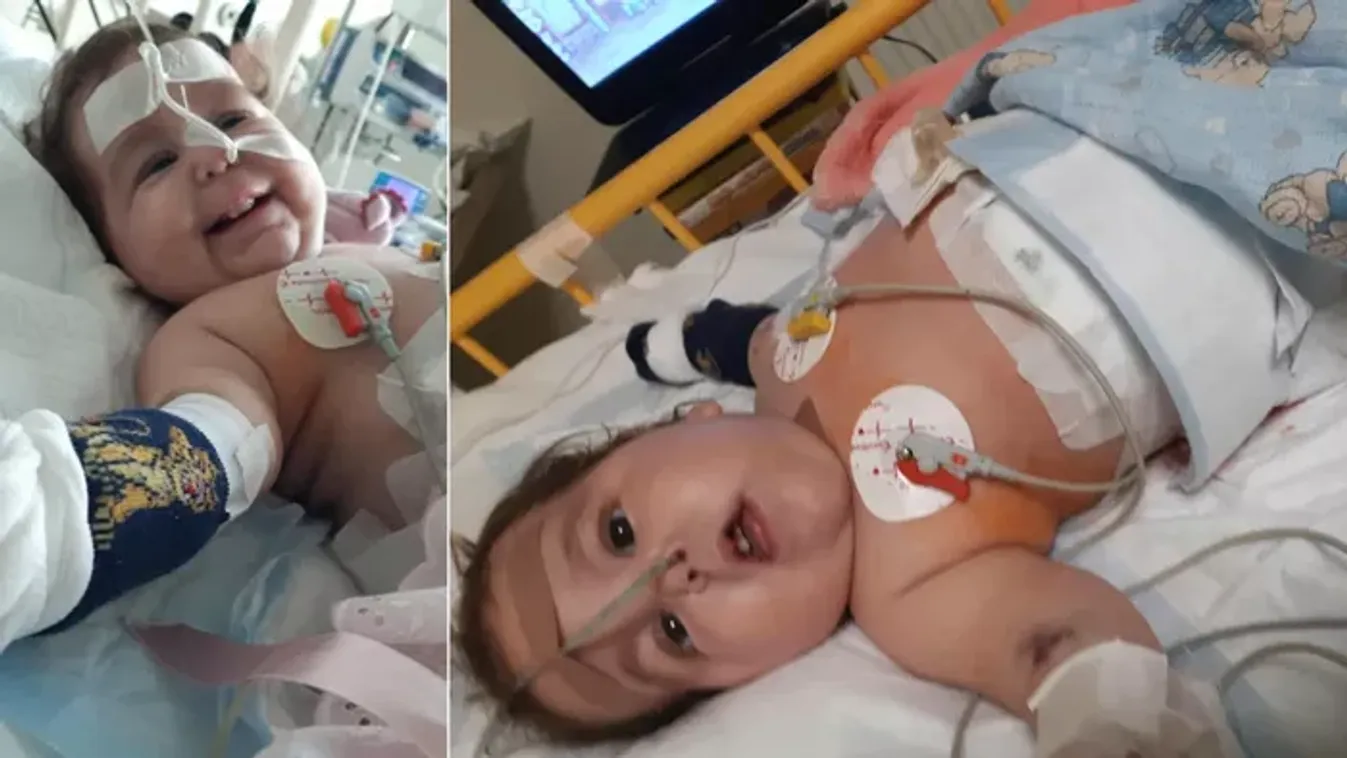 Továbbra is rejtély, milyen betegséggel küzd a kis Maja