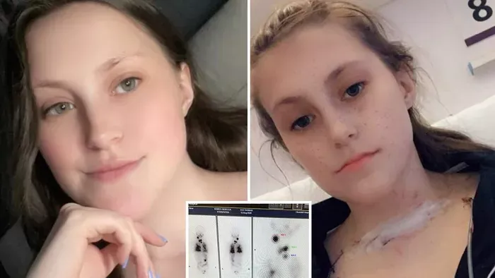 Öt évig nőtt a daganat a fiatal nő torkában